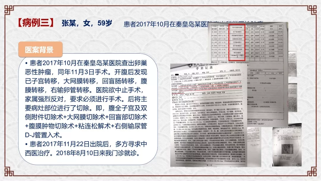 zlynnb5.webp