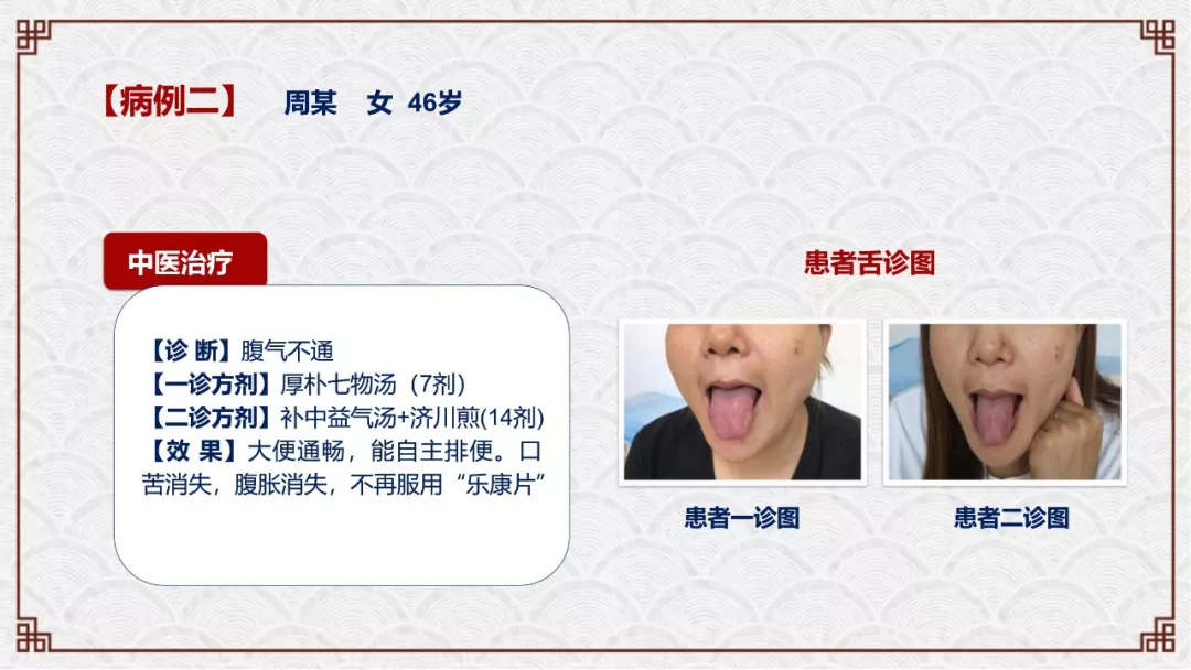 zlynnb4.webp