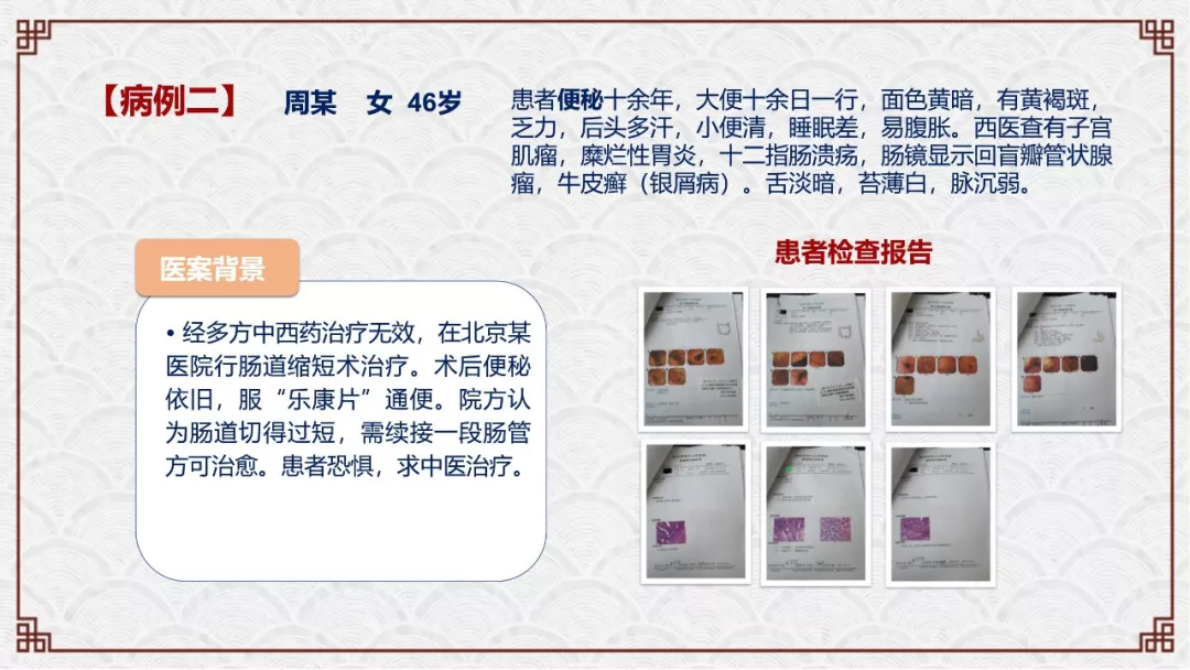 zlynnb3.webp