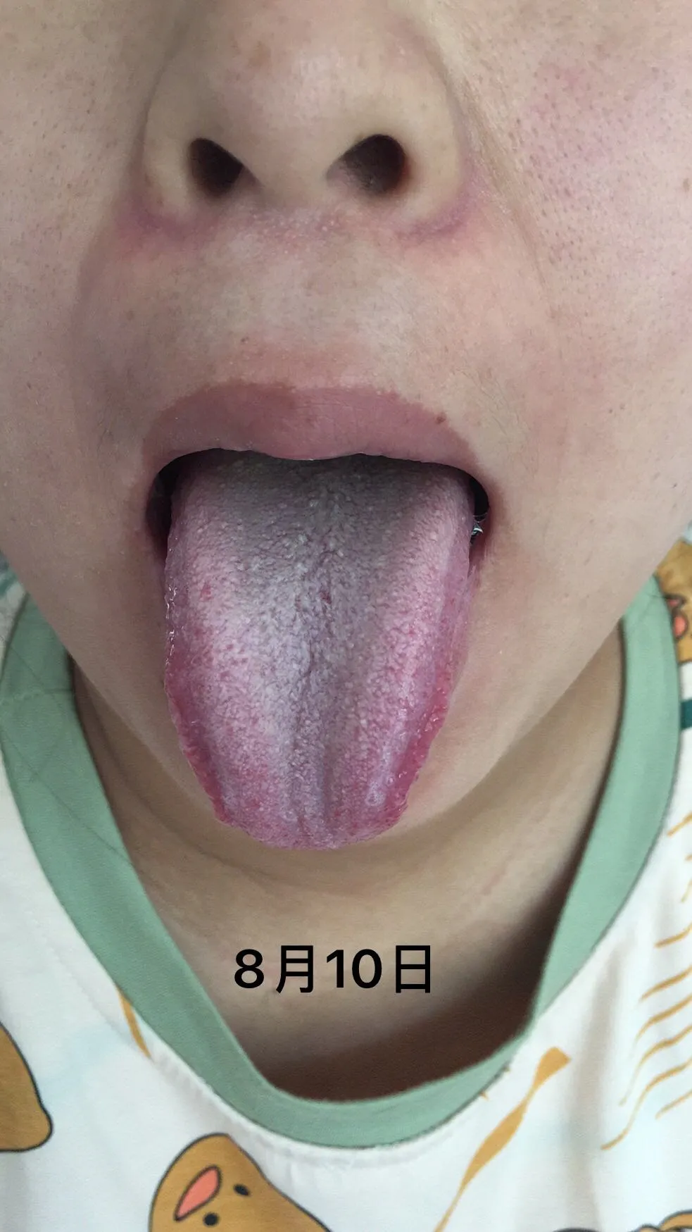 感谢宋老师出手相救，让我妹妹产后大出血失明转危为安