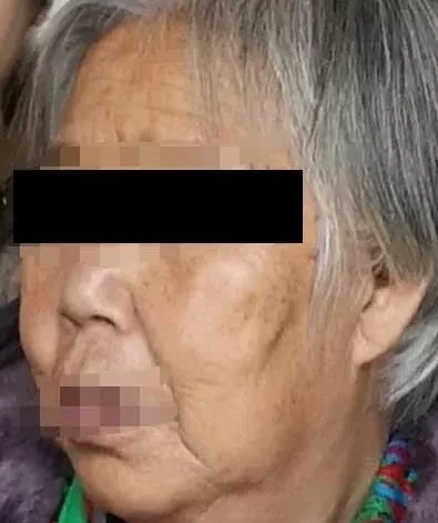 白虎汤竟然能治这么些怪病