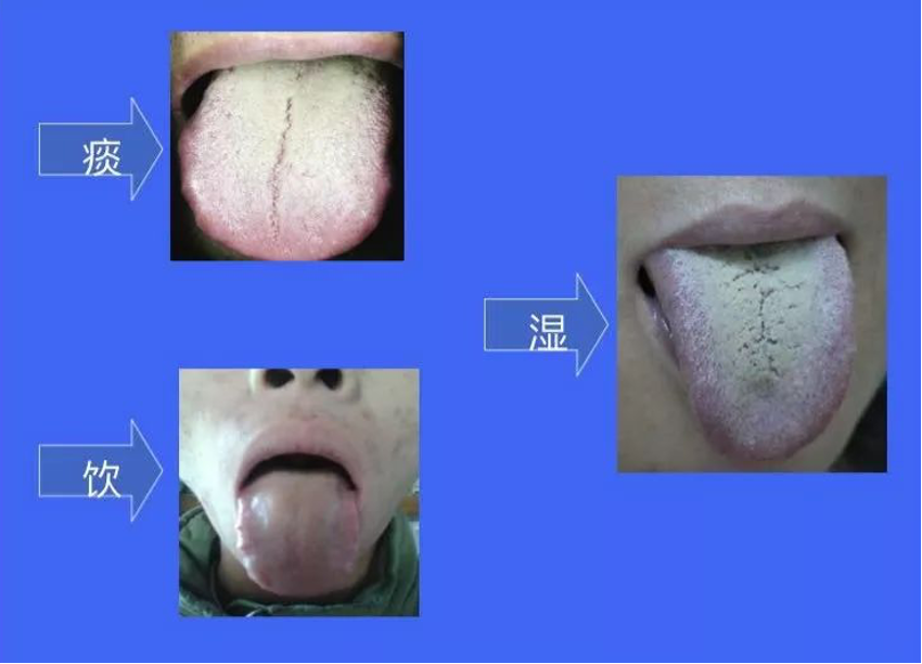 宋柏杉弟子笔记：神效五苓散“神”在何处？——从理论溯源到临床验证的深度解析
