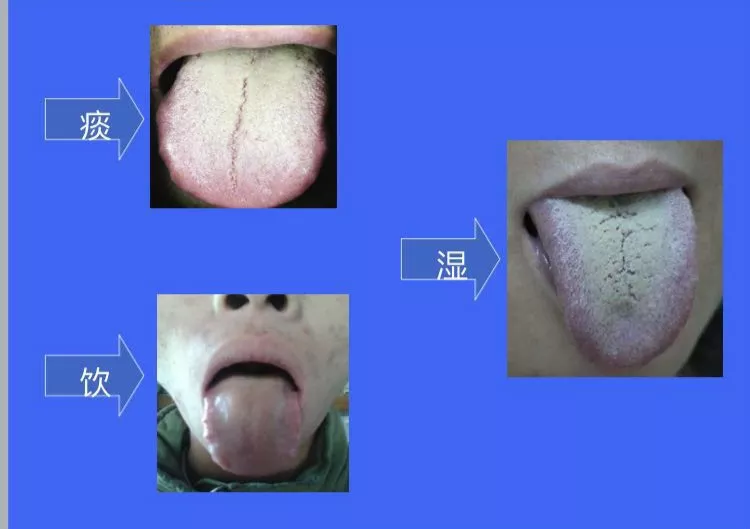 神效五苓散，都在哪些疾病的疗效中堪称神奇呢？