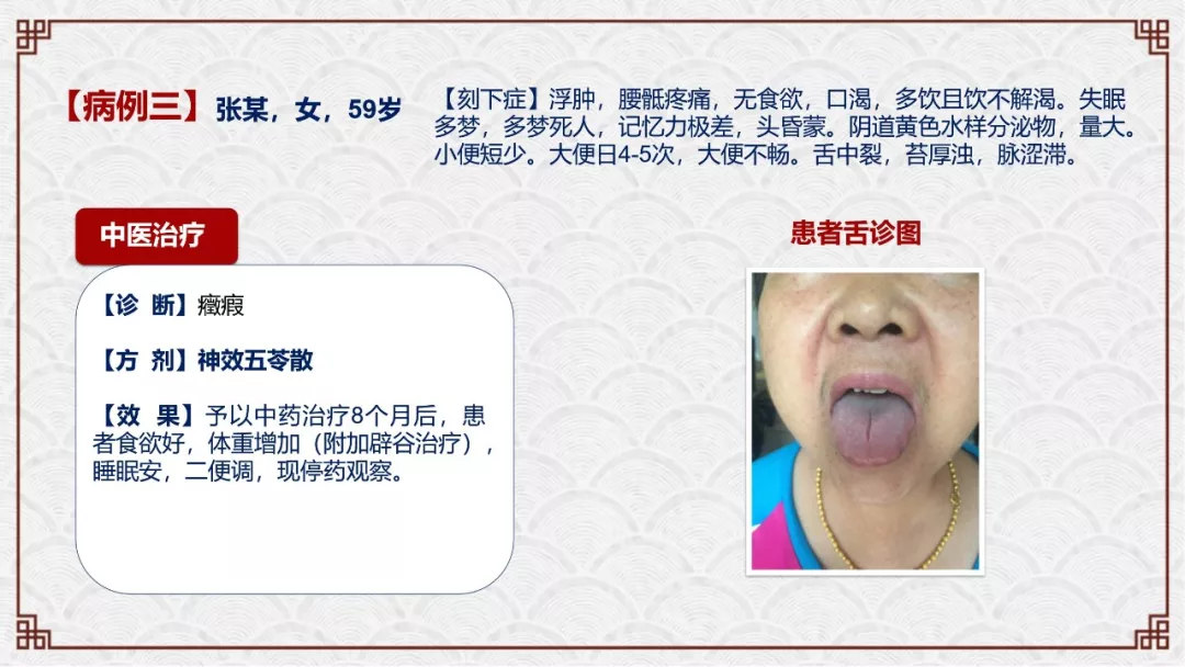 zlynnb6.webp