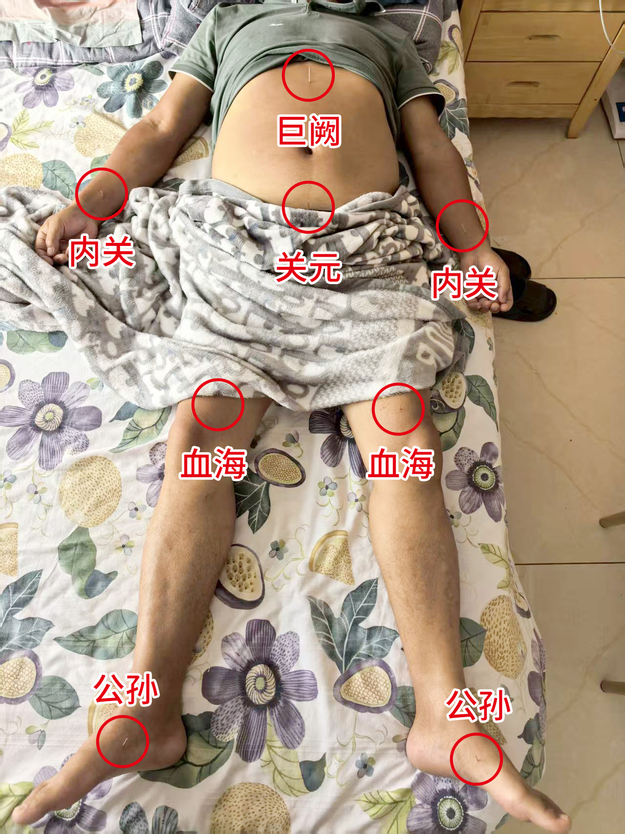 点石医派特刊：纯中医思维指导下的医学奇迹——主动脉夹层病例跟踪