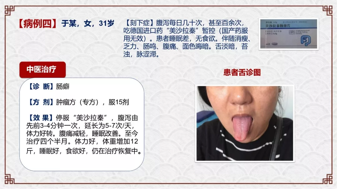 zlynnb9.webp