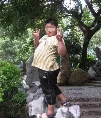 点石医派特刊：从一例肥胖型重度贫血病例——读懂中医 “以饥饿治贫血”的深层逻辑